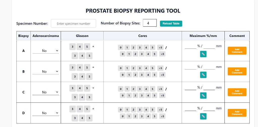 Prostate Biopsy Reporting Tool — site table with Gleason and cores